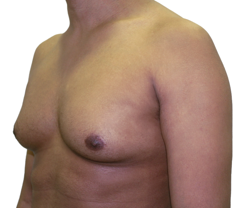 Before Condition