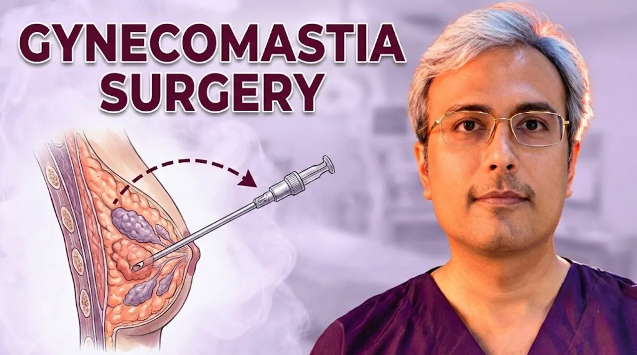 What is Gynecomastia?